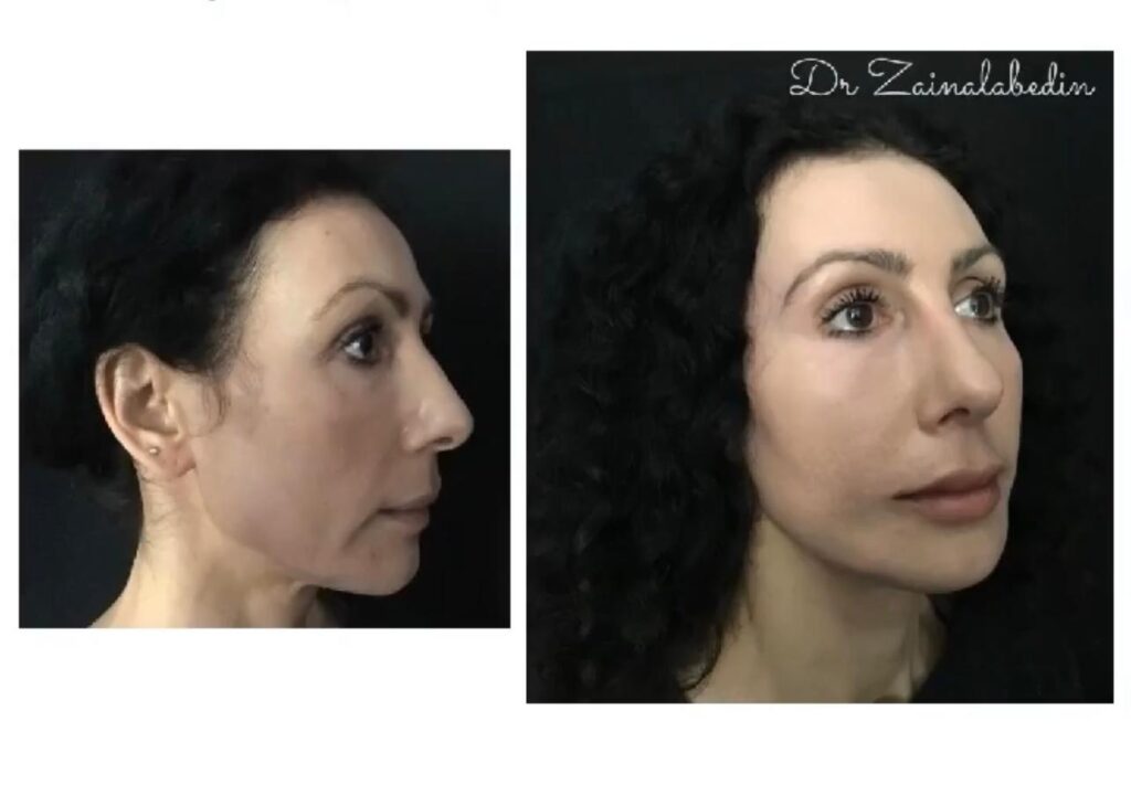 WhatsApp Image 2024 05 19 at 21.24.22