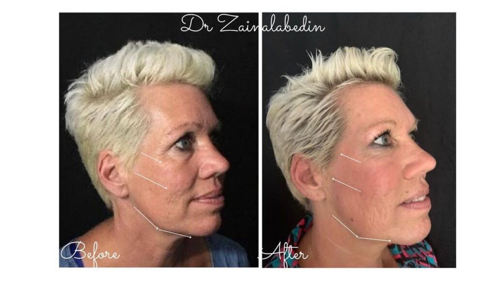 WhatsApp Image 2024 05 19 at 21.25.40