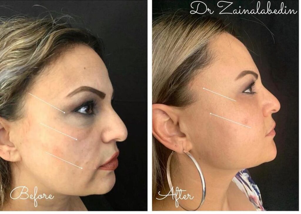 WhatsApp Image 2024 05 19 at 21.49.22