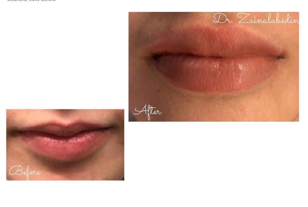 WhatsApp Image 2024 05 19 at 21.50.29