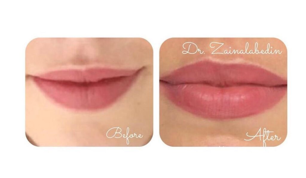 WhatsApp Image 2024 05 19 at 21.51.01