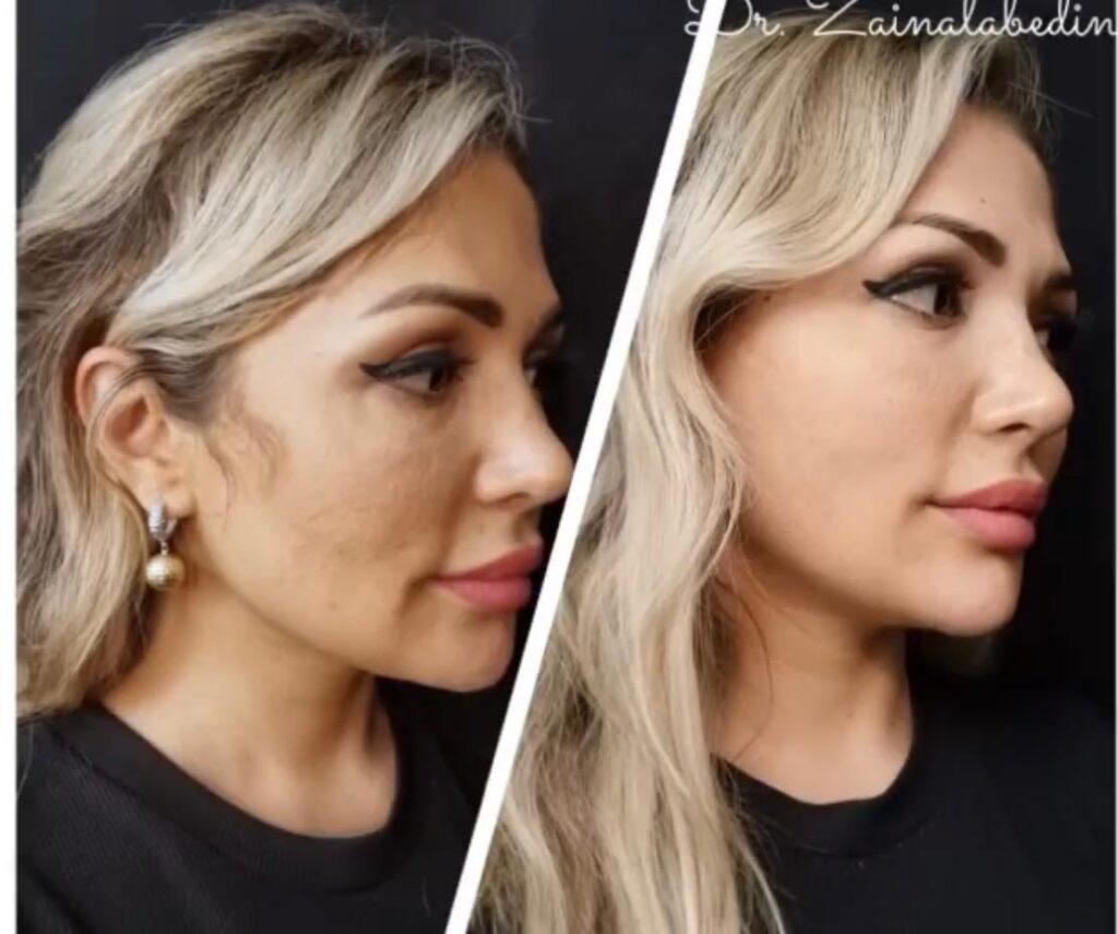 WhatsApp Image 2024 05 19 at 21.53.03